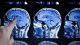 Künstliche Intelligenz als Hilfe für die Radiologie: Start-up erhält sechsstelligen Betrag