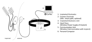 Schematische Darstellung der Komponenten des CorTec Brain Interchange™ Systems