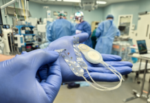 CorTec hat zum zweiten Mal erfolgreich sein Brain-Computer-Interface-System beim Menschen implantiert (c) CorTec