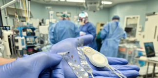 CorTec hat zum zweiten Mal erfolgreich sein Brain-Computer-Interface-System beim Menschen implantiert (c) CorTec