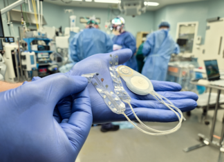 CorTec implantiert BCI-System zum zweiten Mal erfolgreich CorTec hat zum zweiten Mal erfolgreich sein Brain-Computer-Interface-System beim Menschen implantiert (c) CorTec