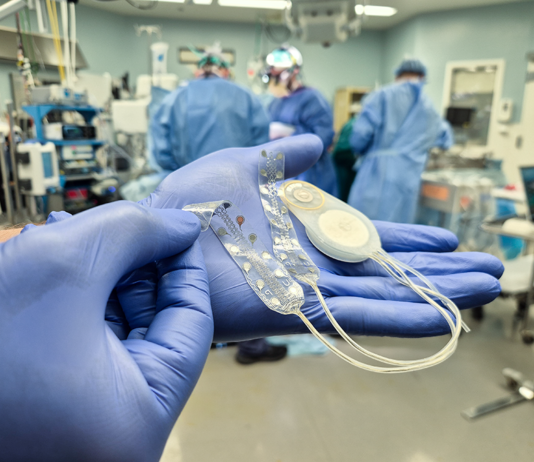 CorTec hat zum zweiten Mal erfolgreich sein Brain-Computer-Interface-System beim Menschen implantiert (c) CorTec