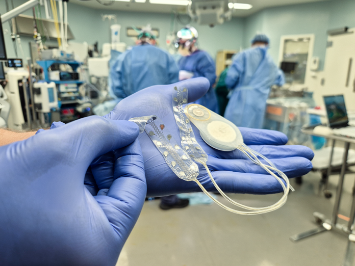 CorTec hat zum zweiten Mal erfolgreich sein Brain-Computer-Interface-System beim Menschen implantiert (c) CorTec