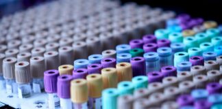 Foto von Testalize.me auf Unsplash