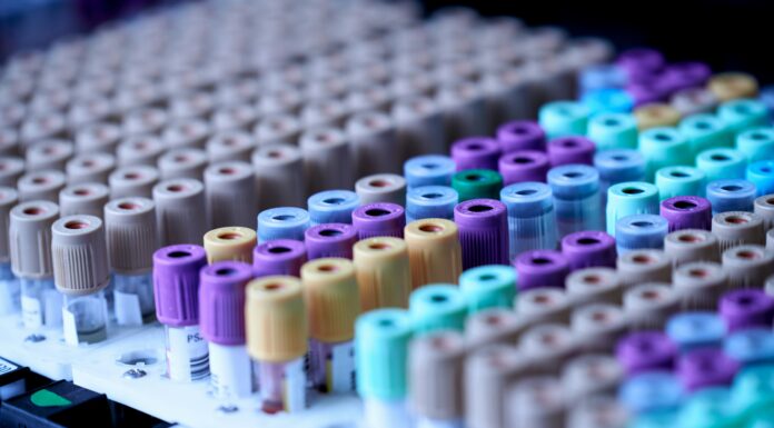 Foto von Testalize.me auf Unsplash