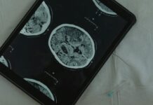 MIG Capital beteiligt sich an TIBEAY Biosciences Pexels